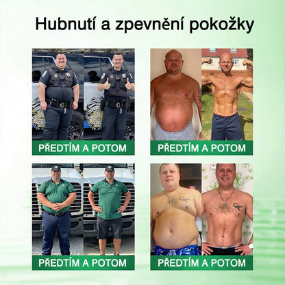 🇨🇿 Oficiální obchod👑 | 👨‍⚕️GFOUK® Moringa · Berberine × NAD+ 10v1 Pokročilá nano mikronáplast